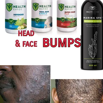 Head and face bumps treatment 